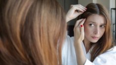 Сух скалп – 7 причини за проблема