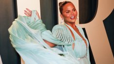 Криси Тейгън си направи липосукция на бузите