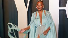 Не, това не са филъри по Криси Тейгън, алергия е