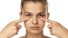 Как да се отървете от торбичките под очите