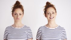 Здраве и красота – как настроението влияе на кожата ви