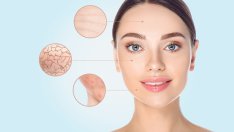 Дехидратирана кожа – какви са признаците и как да я лекувате