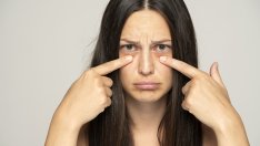 Торбички под очите – 5 натурални средства, с които да ги премахнете