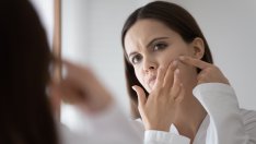 Черни точки – как да ги премахнем, без да нараним кожата?