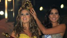 Мис Колумбия 2011 с ампутиран крак след операция 