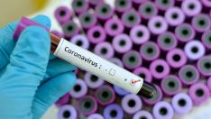 Какво да правите, ако имате леки симптоми на COVID-19?