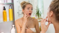 Диета при акне –  какво да ядете за по-чиста кожа?