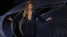 Ейми Шумър разкри, че имала трихотиломания