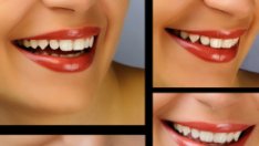 Медитация със смях