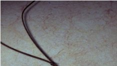 Най-добрият съвет