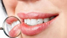 Модерни зъби с блясък и рисунки