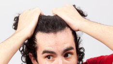 ДНК тест ви казва дали ще оплешивеете