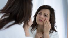 Как да се справим с торбичките под очите?