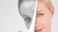 Десетминутна процедура премахва торбичките под очите