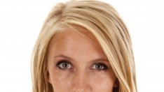 Ботоксът бори не само бръчките, а и потта