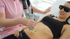 Истината за лазерната епилация