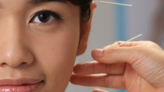 Акупунктура на ушите – новият начин да отслабвате