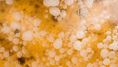 Нещата, които не знаете за мазнините в тялото си