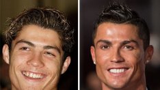 Звездни трансформации на усмивки: Том Круз, Майли, Роналдо...