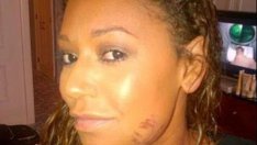 Мел Би с ужасяващи разкрития за брака си: Съпругът ѝ я душил, влачил