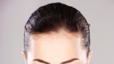 Хирургично лепило измества шевовете на клепачите