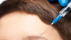 Операция на вежди