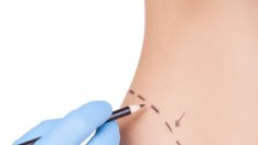 Помислете пак, преди да легнете под ножа