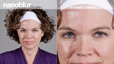 О, чудо! 10 години по-млада за 40 секунди