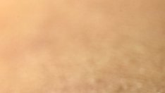 Защо комарите хапят повече жени