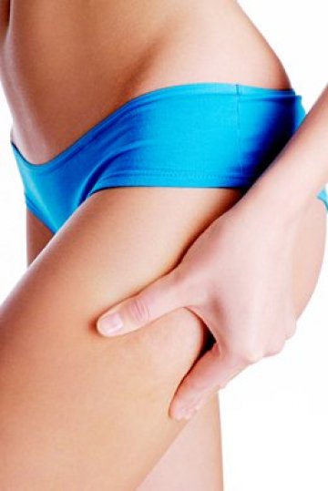 Борбата е безмилостно жестока, но няколко лесни правиал ще ви помогнат да победите целулита. Снимка: Dreamstime