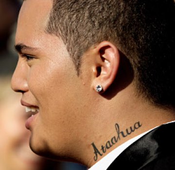 Стан ще е белязан с &quot;красив&quot; завинаги. Снимка: Gettyimages/Guliver