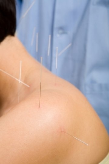 Снимка: Dreamstime