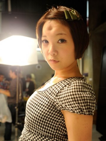 Момиче с операция на челото; Снимка: pearshapedthoughts.com