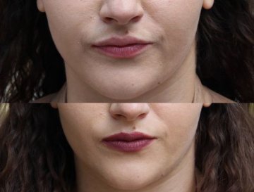 Снимка: Tialoto.bg