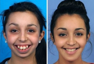 Снимки: ofigenno