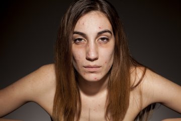 Източник: IStockphoto