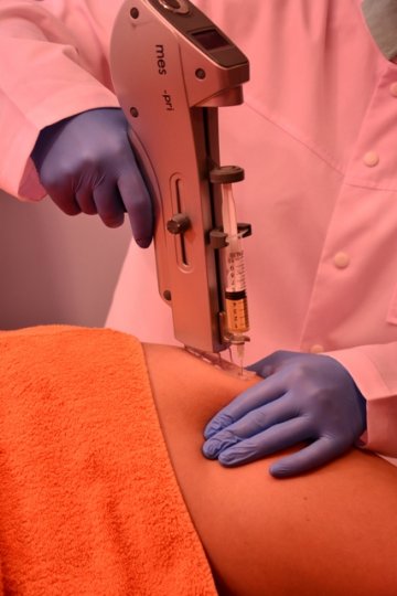 Снимка: "Вита Естетик Център"