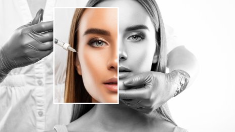 Вампирско лице – странната тенденция, в която се използва собствената ви кръв