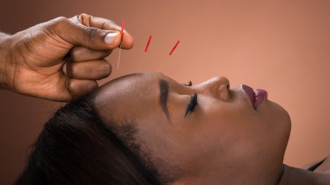 Лицева акупунктура – новият стар метод за подмладяване