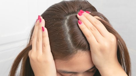 Съвети за красота - домашни средства срещу пърхота