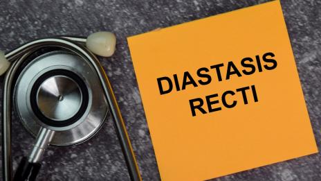 Какво трябва да знаеш за диастаза ректи