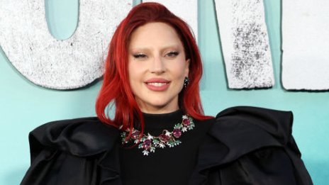 Какво се случва с лицето на Лейди Гага?