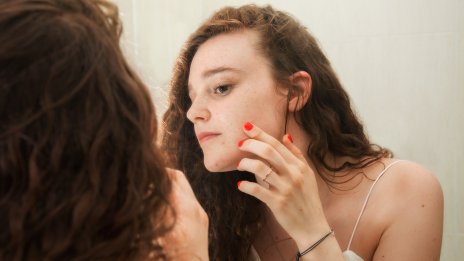 Хормонално vs бактериално акне – от какво страдате и как да го лекувате?
