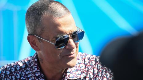 Роби Уилямс разказа за неуспешното си трансплантиране на коса 