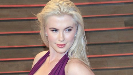 Айрланд Болдуин си направи лифтинг на лицето на 26 години!