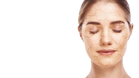 Суха кожа през есента и зимата – как да я лекувате