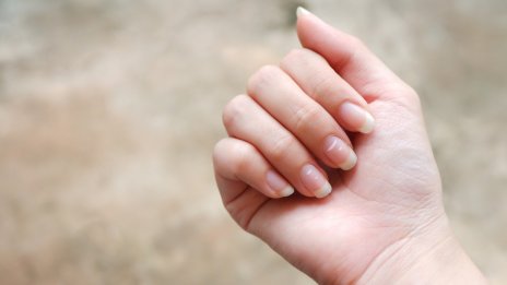 Бели петна по ноктите – какво означават?
