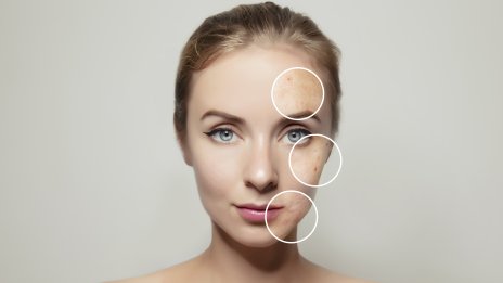 Запушени пори – 7 съставки, които да избягвате