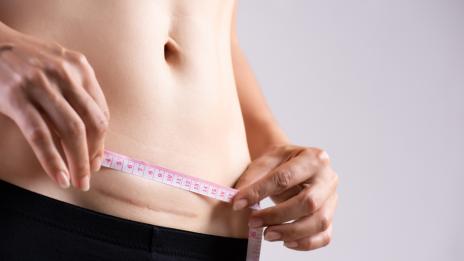 Жената на Танцуващия милионер показа как се възстановява след секцио