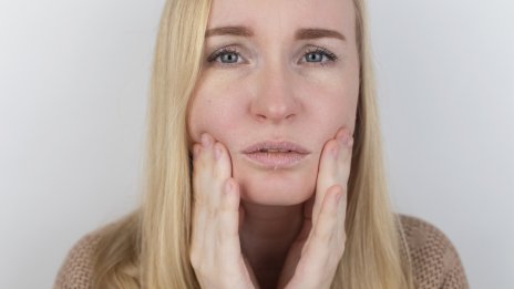 Защо устните ви се цепят в краищата и какво можете да направите за това